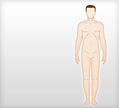 Liposuction by Body Parts