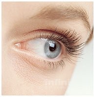 BigEye