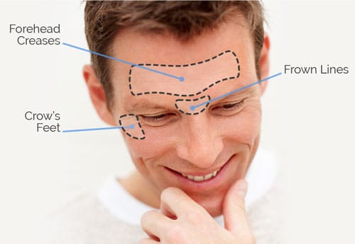 Male Liposuction in Scottsdale