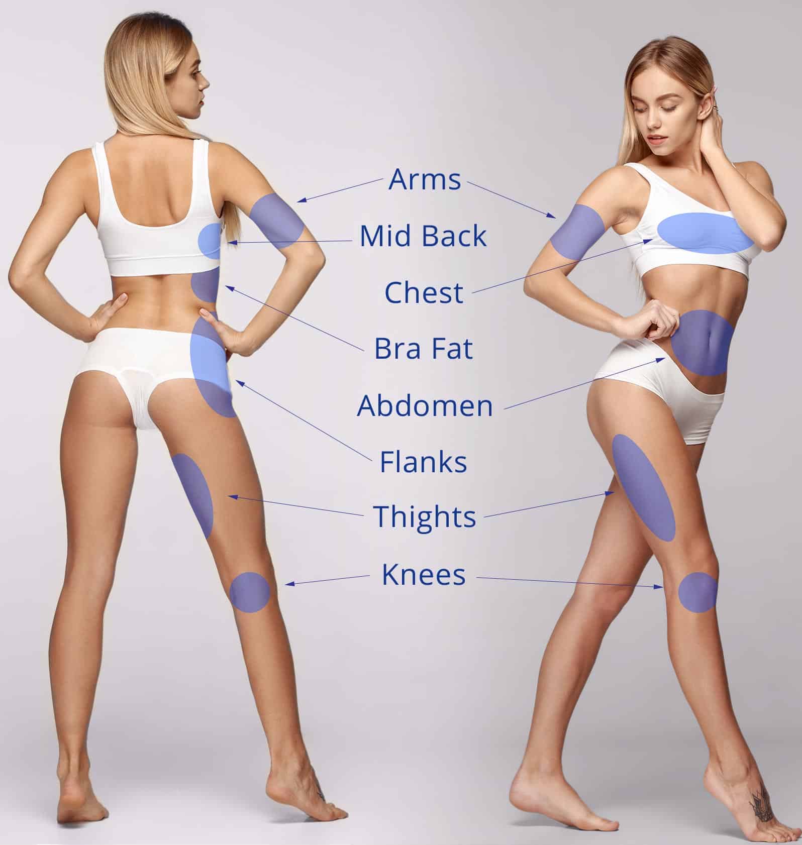 J-Plasma skin tightening treatment areas Scottsdale
