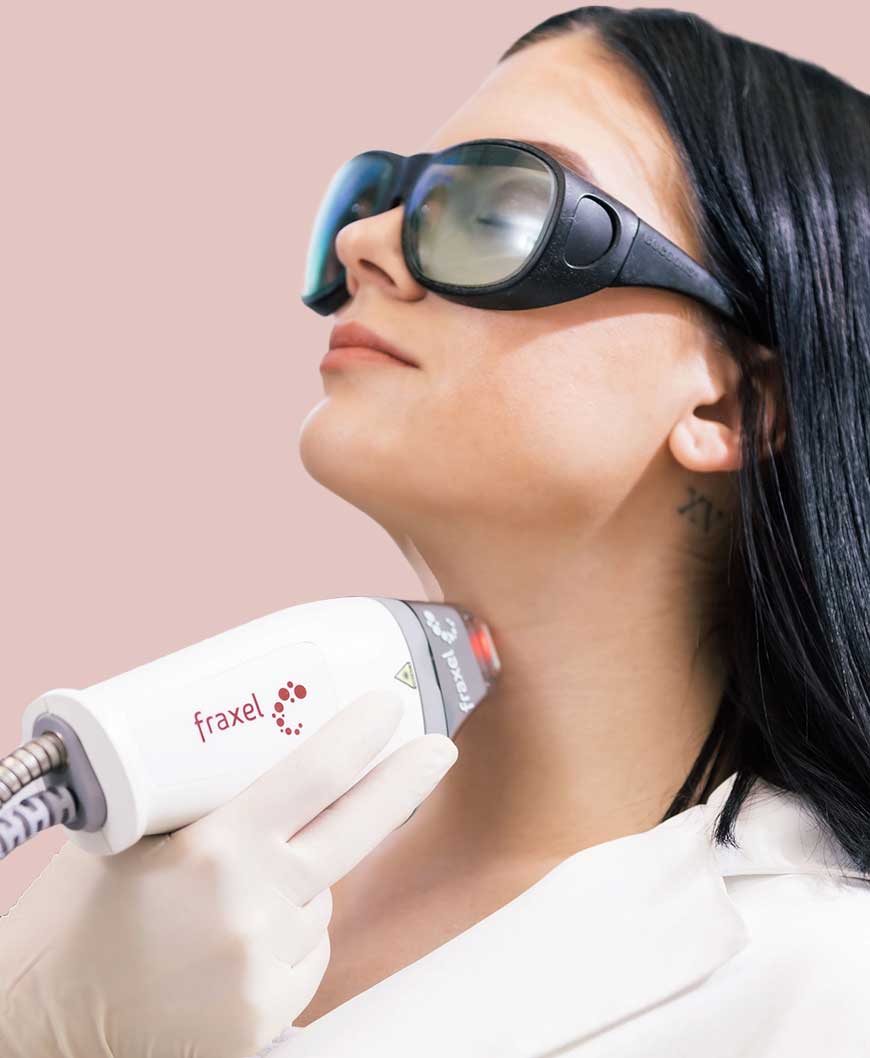 Tratamiento con láser Fraxel realizado por esteticista experto en Infini Cosmetic en Scottsdale