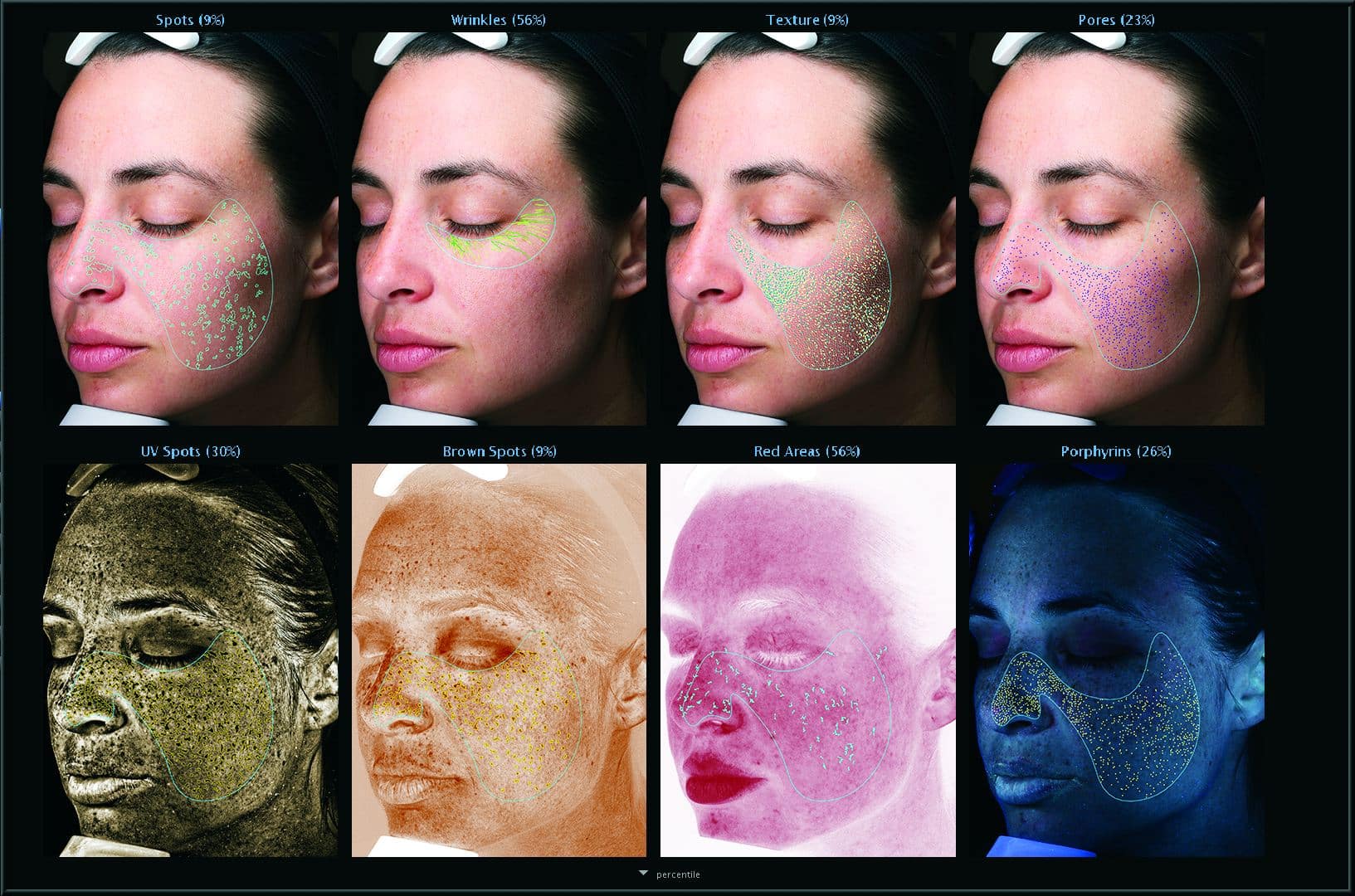 Comprehensive Skin Analysis Report