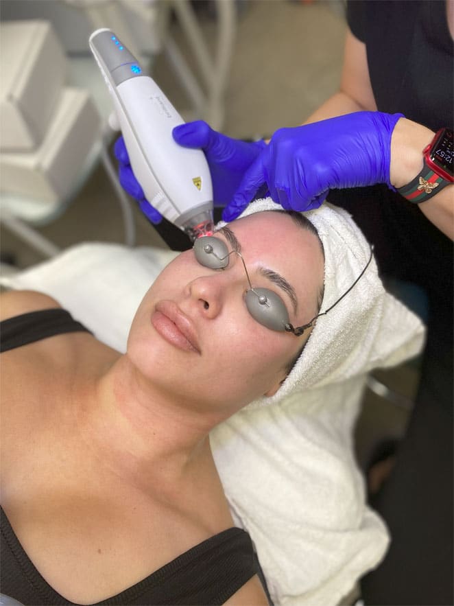 Before and after Clear + Brilliant laser results Scottsdale patient showing improved skin texture and glow