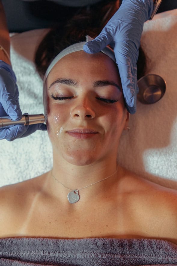 Microneedling with PRP growth factors being applied