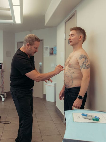 Male Chest Liposuction Result