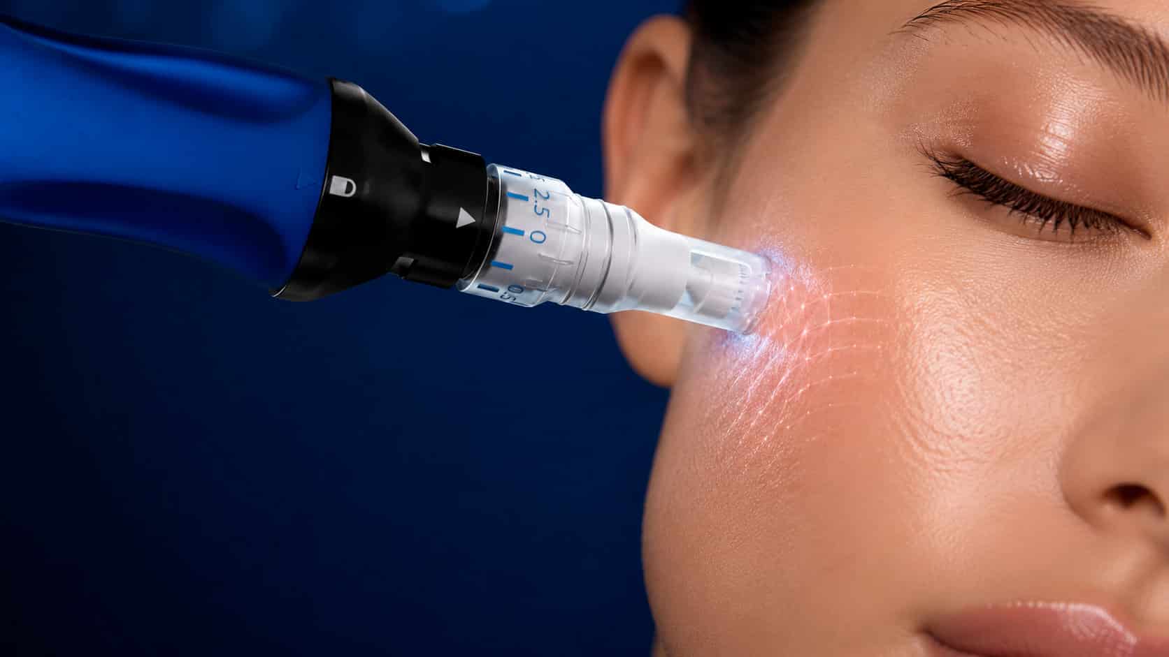 SkinPen ELITE microneedling technology