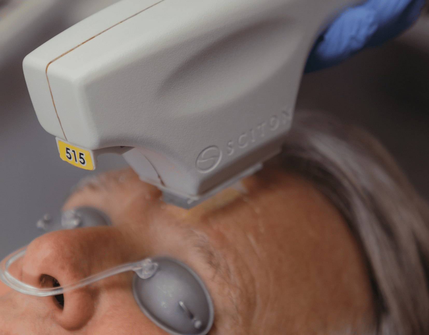 PHOTOFACIAL $250